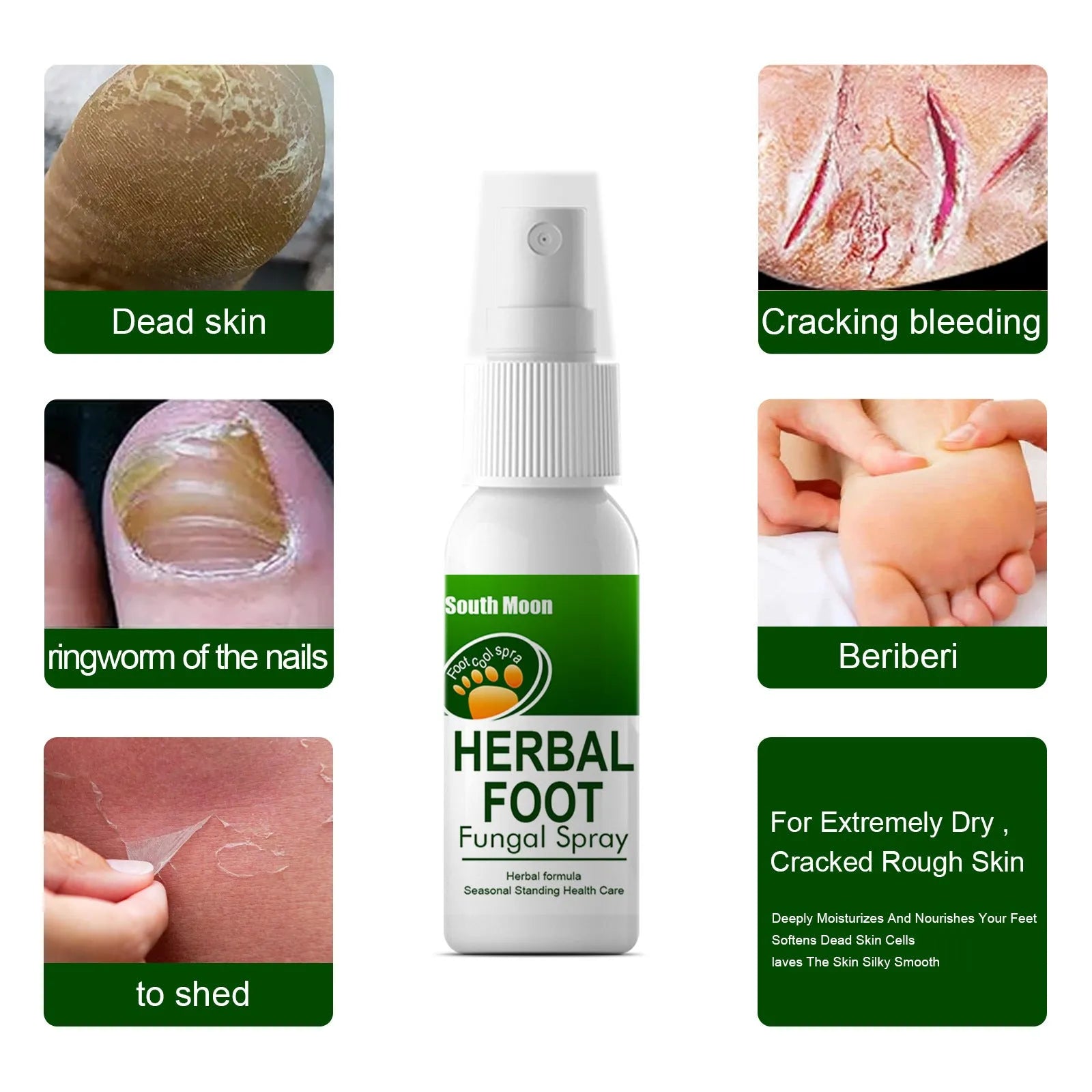 30ml foot care spray bottle for dry skin hydration on feet and heels