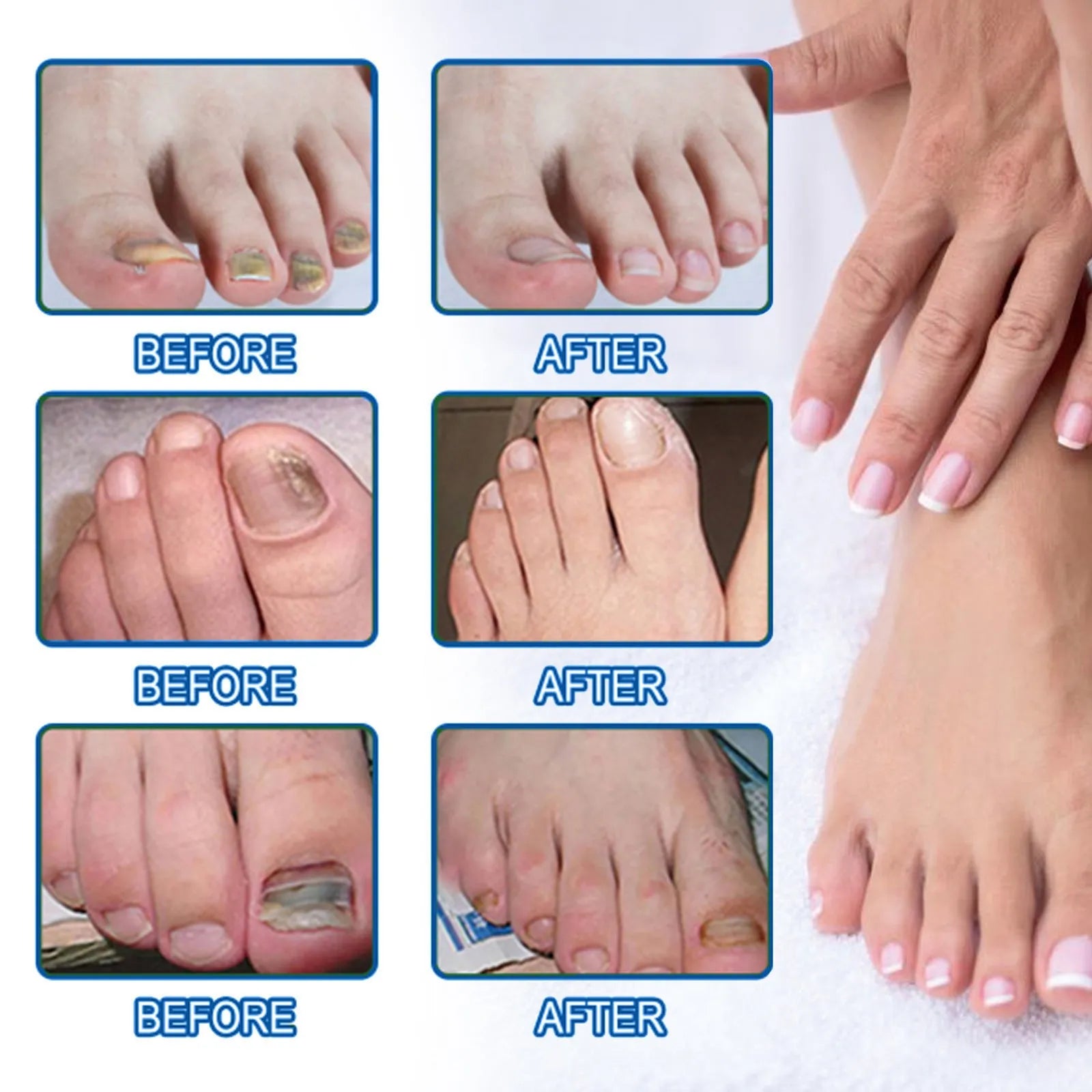 Nail nursing adhesive bandage repair with 32 patches measuring 6.1x3.5cm containing glycerin and natural extracts