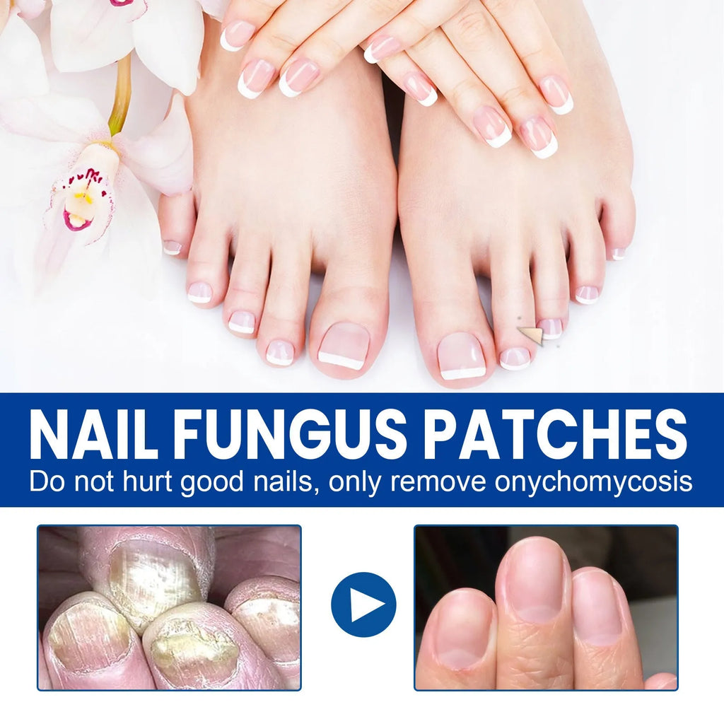 Nail nursing adhesive bandage repair with 32 patches measuring 6.1x3.5cm containing glycerin and natural extracts
