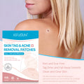108 white Vitamin A wart and skin tag remover patches for home use