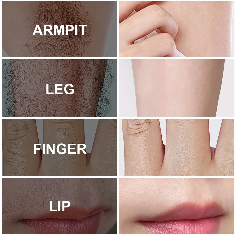 PHOFAY pain-free hair removal cream tube and included scraper tool, shown in two colour options.
