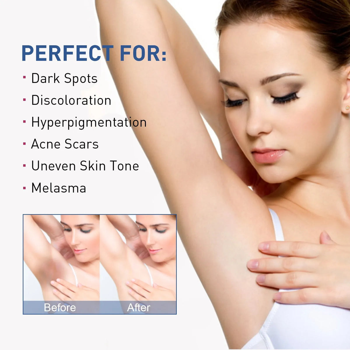 30ml body whitening cream tube for underarm and dull skin with nicotinamide, vitamin E, retinol, hyaluronic acid