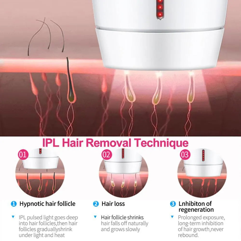 White home IPL laser hair removal device on a table.