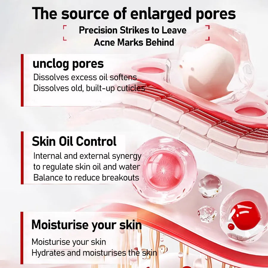 30ml facial essence bottle with salicylic acid and tartaric acid for women, all skin types