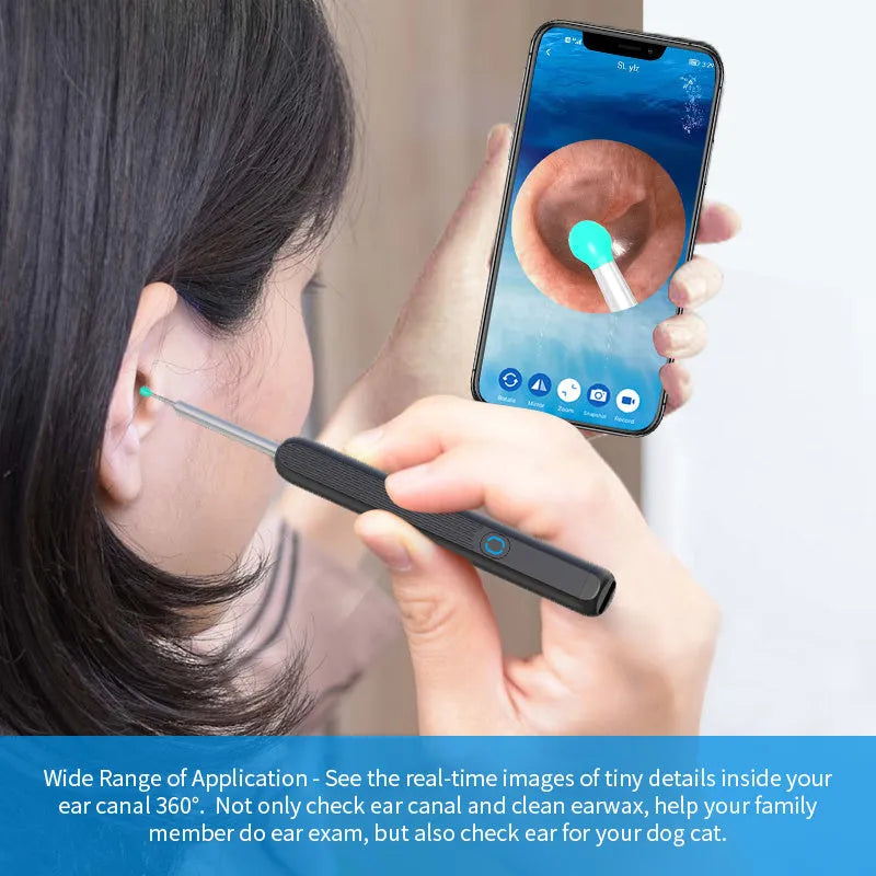 Black and white wireless otoscope ear cleaner with camera, LED light, and spoon heads on a table.