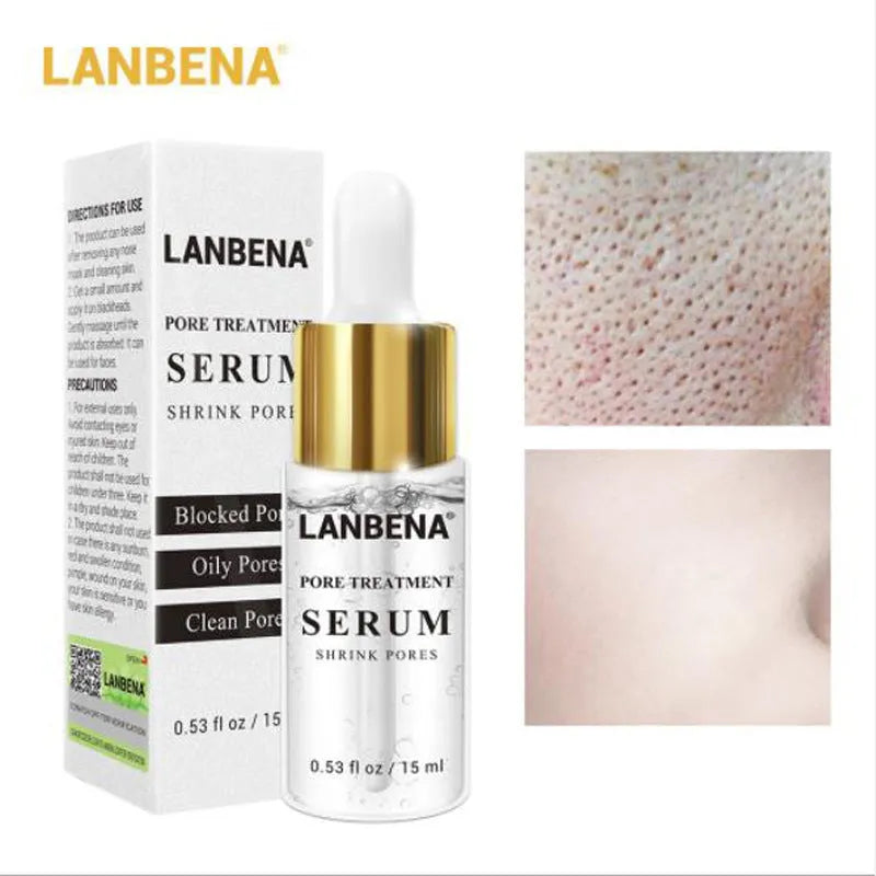 15ml pore treatment serum with witch hazel flower water for blackhead care and large pores