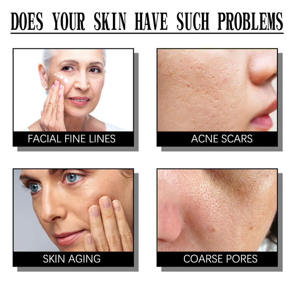 50g jar of salicylate exfoliating cream for smallpox marks, a nourishing moisturiser.