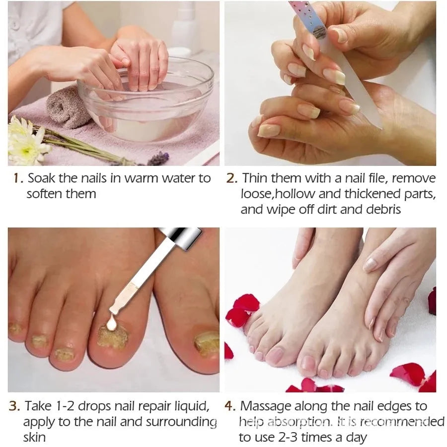 Jiagou Repair Dust For Deck Liquid Antimicrobial 10ml bottle with Whitenail Antibacterial Liquid for toenail treatment