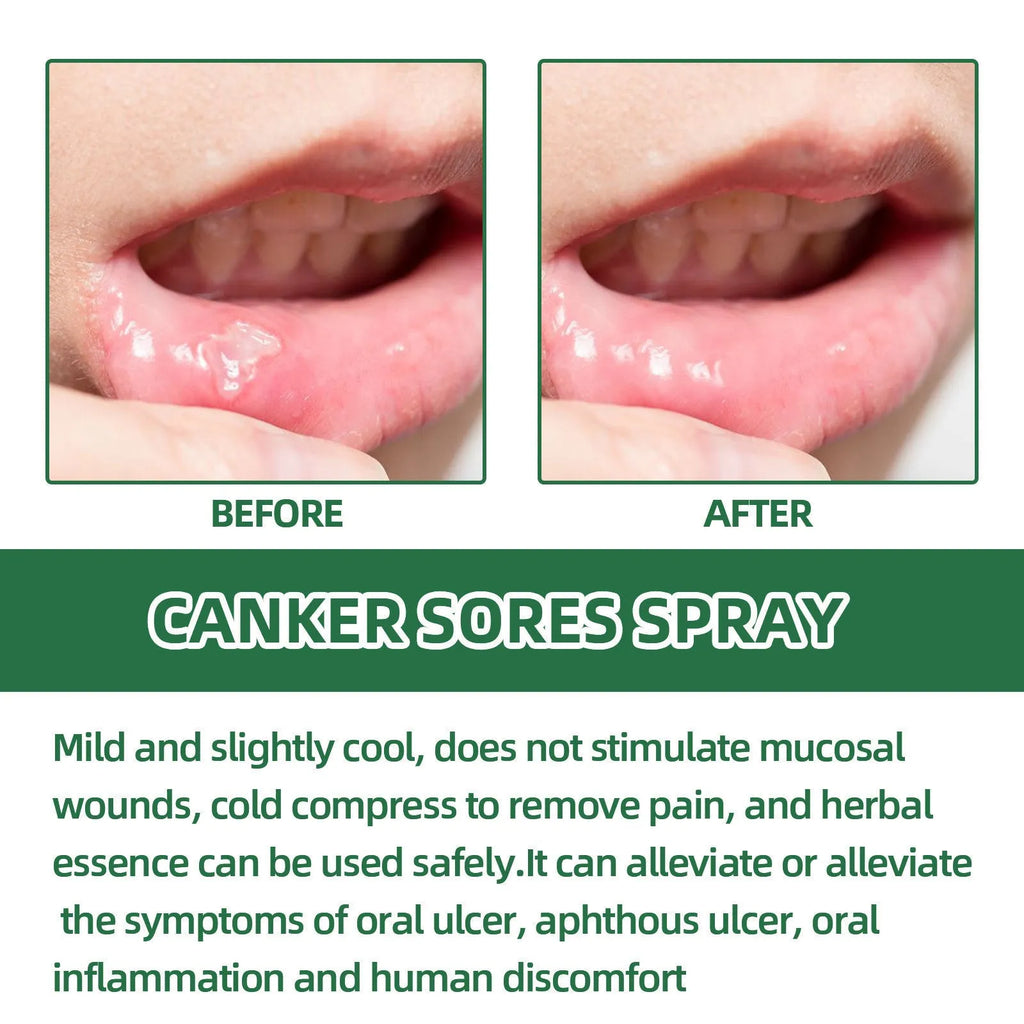 20ml mint oral care spray in boxed packaging for breath cleaning and odour control