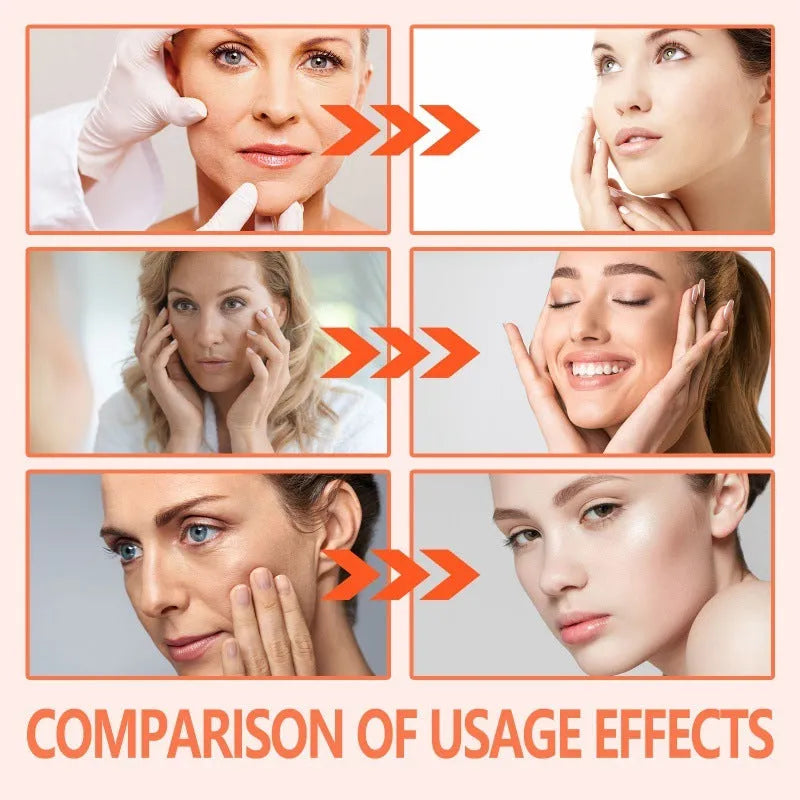 30ml bottle of rose essential oil for smoothening wrinkles and brightening skin.