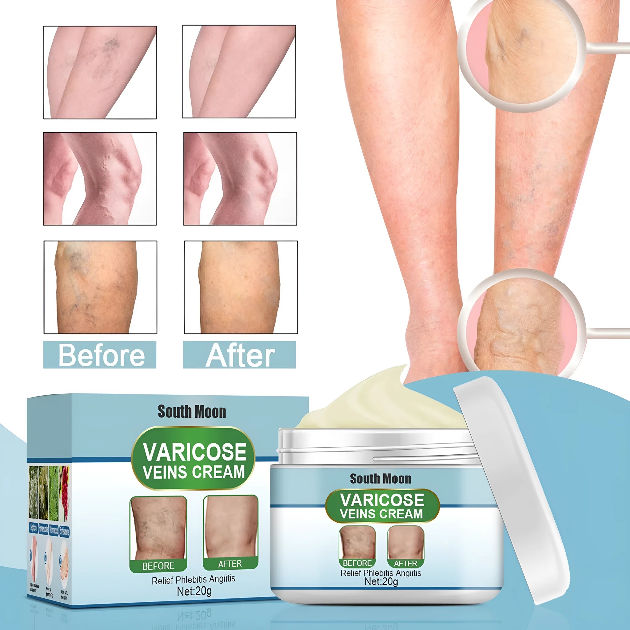 20g vein repair cream tube for leg vein and tendon bulge relief