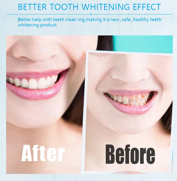 Gold aluminium case teeth whitening pen with brush tip applicator for whitening gel.