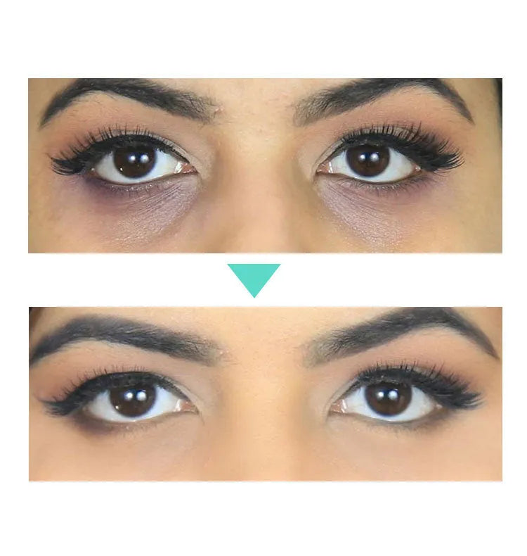 Beauty Eye Cream product in a 30ml container for eye contour skincare.