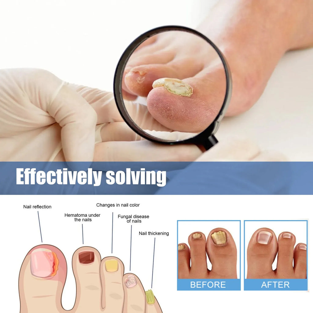 Nail nursing adhesive bandage repair with 32 patches measuring 6.1x3.5cm containing glycerin and natural extracts