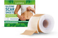 One roll of silicone scar sheet measuring 4cm wide by 150cm long for scar treatment