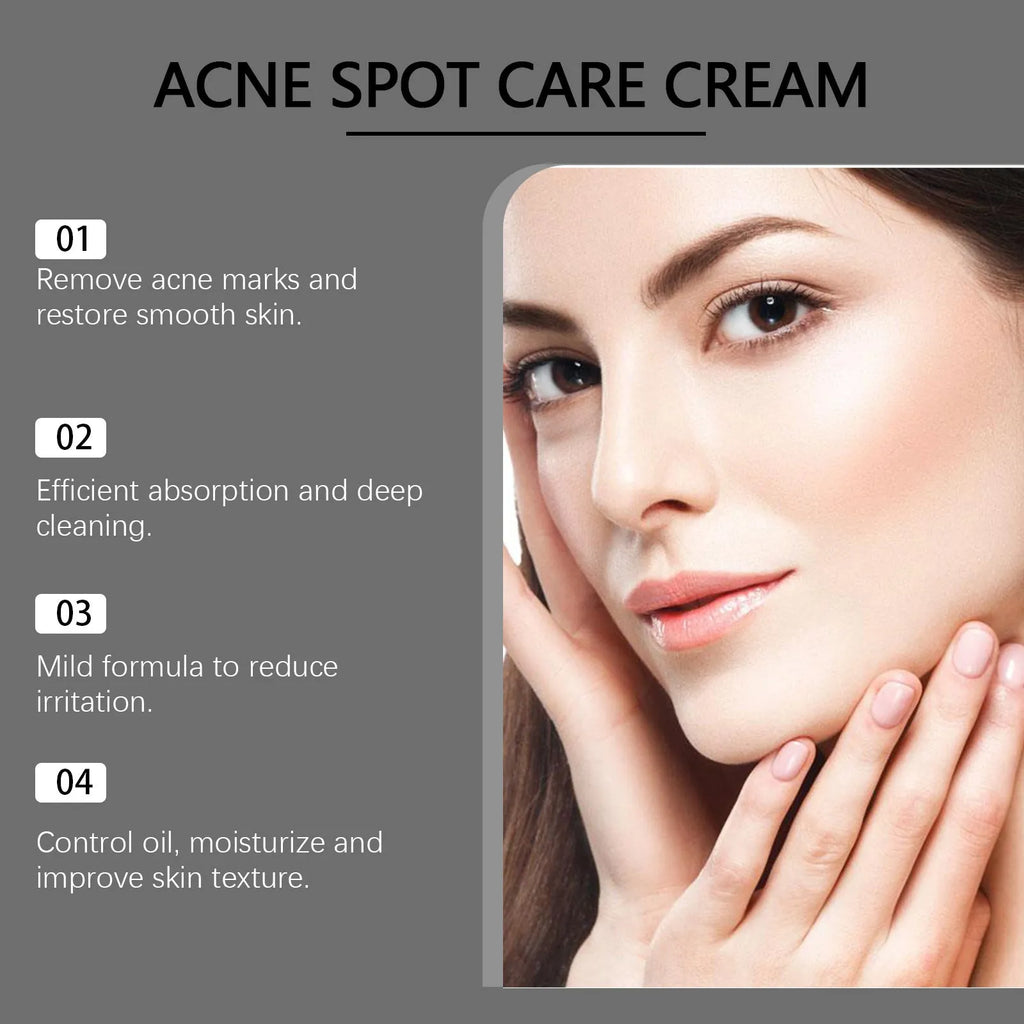 15g tube of acne cream with mint leaf, tea tree oil and aloe vera ingredients