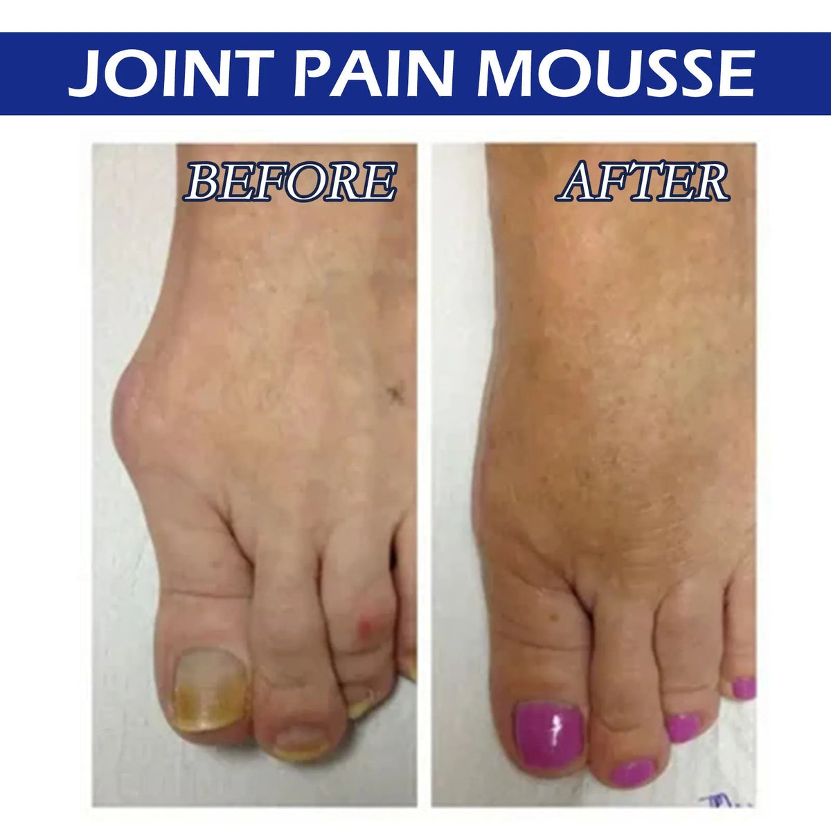 15ml bottle of herbal Care Drops for joint and muscle massage relief