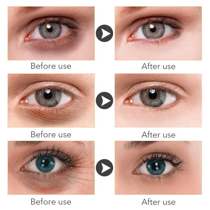 Beauty Eye Cream product in a 30ml container for eye contour skincare.