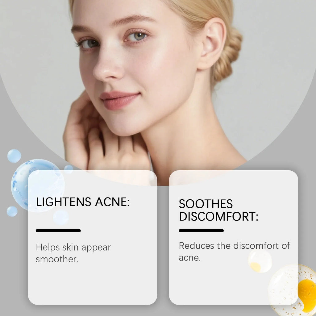 80 transparent hydrocolloid acne patches in a pack for pimple and blemish treatment