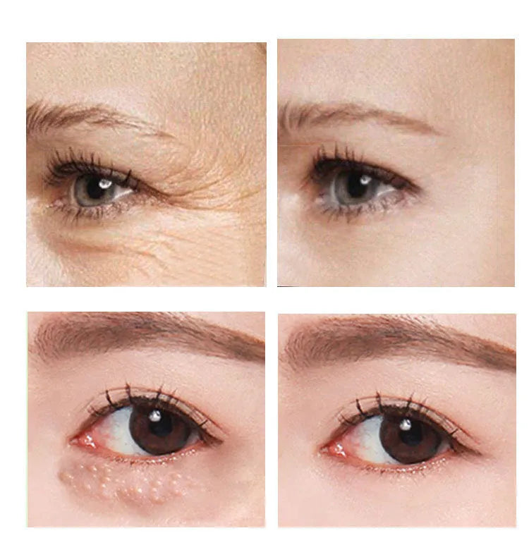 Beauty Eye Cream product in a 30ml container for eye contour skincare.