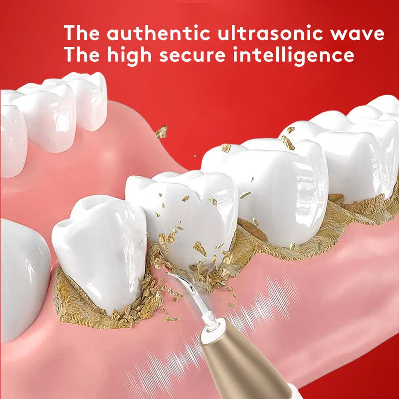 Gold ultrasonic tooth cleaner with three cleaning heads on charging cable next to storage case