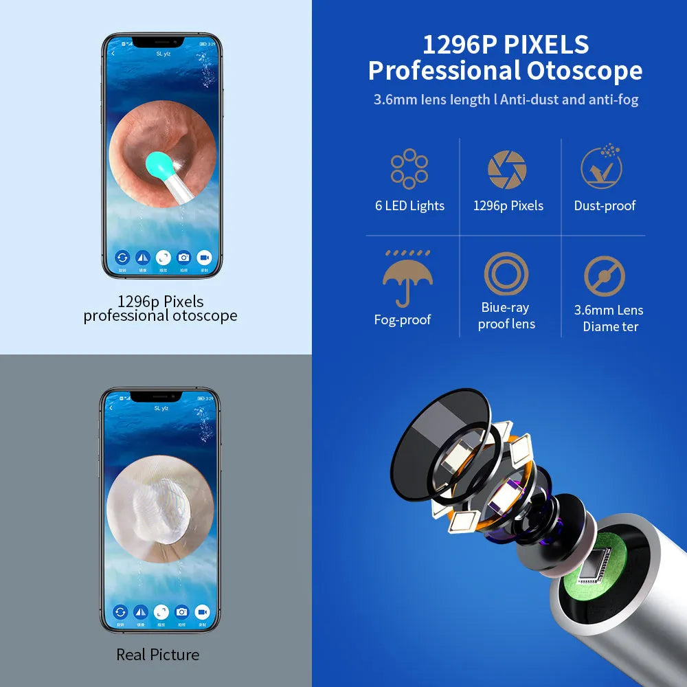 Black and white wireless otoscope ear cleaner with camera, LED light, and spoon heads on a table.